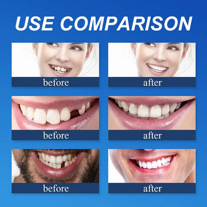 CLINCLII™ --Advanced Customized Full Denture Set🦷