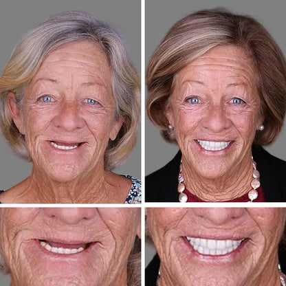 CLINCLII™ --Advanced Customized Full Denture Set🦷