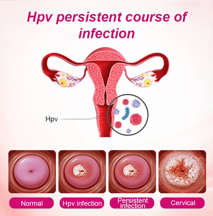 Alisanda Feminine Care Gel image Alisanda Feminine Care Gel