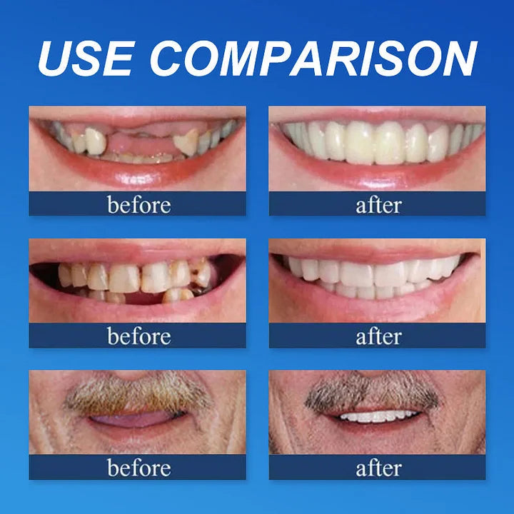 CLINCLII™ --Advanced Customized Full Denture Set🦷